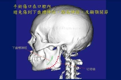 https://www1.cgmh.org.tw/intr/intr2/c32540/photo/img-facial3-001.jpg